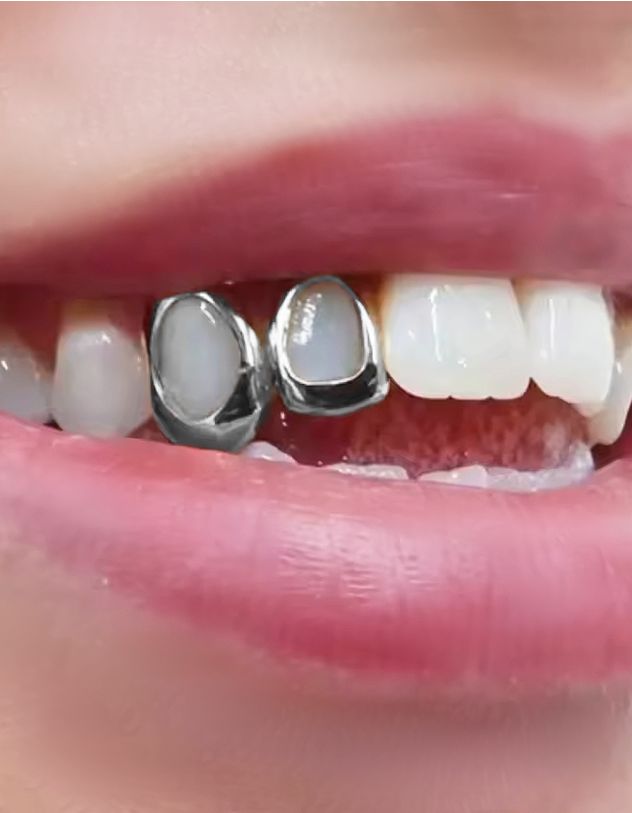 Грілзи подвійні | 265663-05-XX - A-SHOP