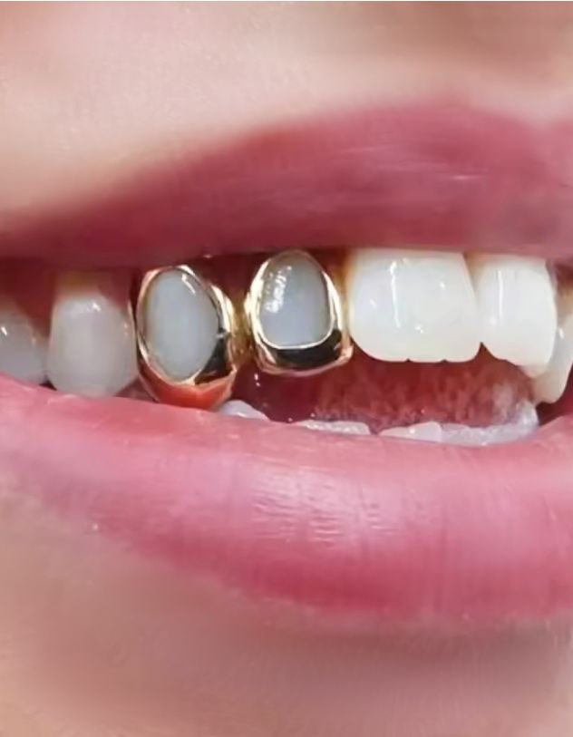 Грілзи подвійні | 265663-04-XX - A-SHOP