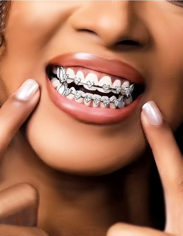 Грілзи з серцями у стразах | 266427-05-XX - A-SHOP